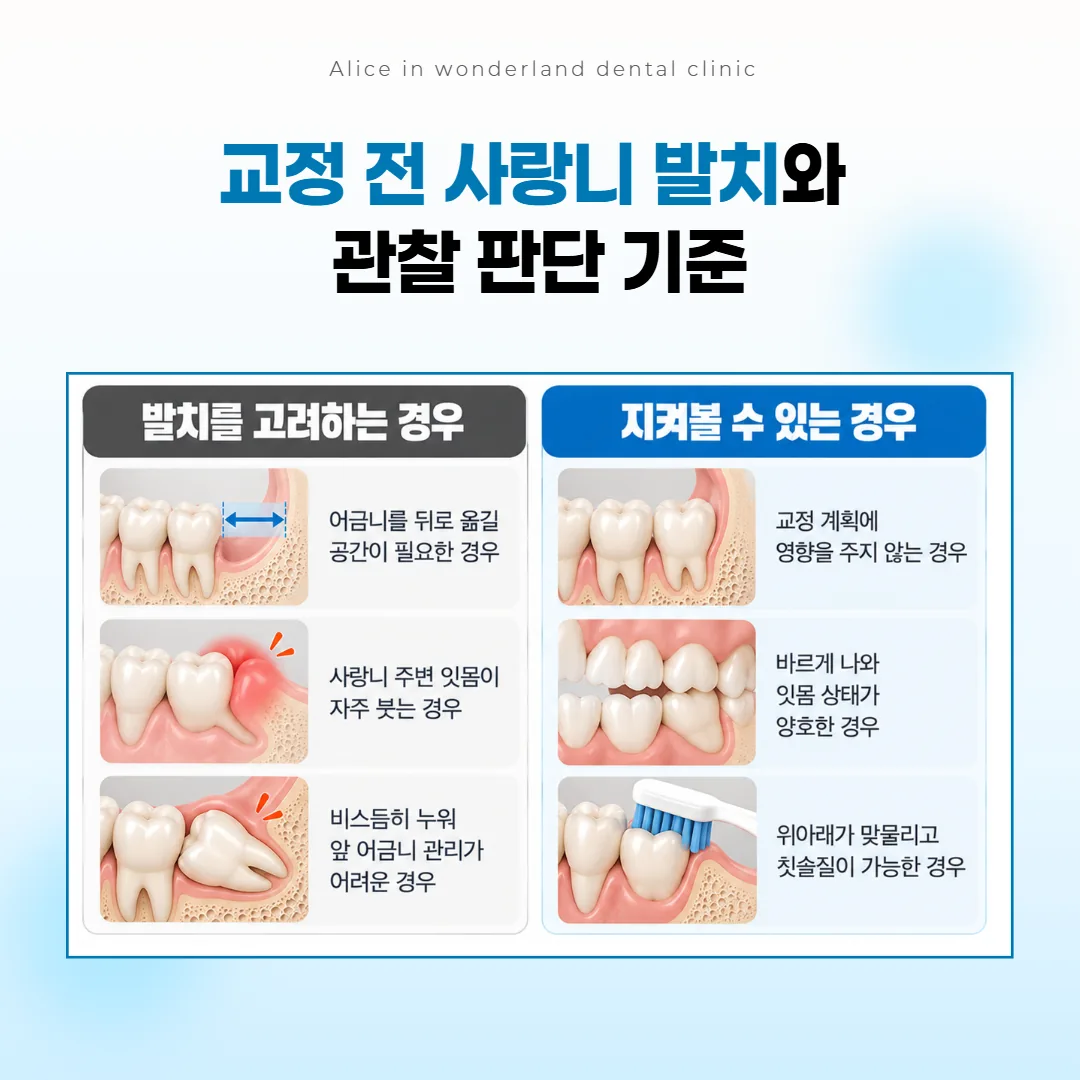 교정 전 사랑니를 빼는 쪽으로 정하는 경우와 지켜보는 경우를 두 칸으로 나눈 기준표