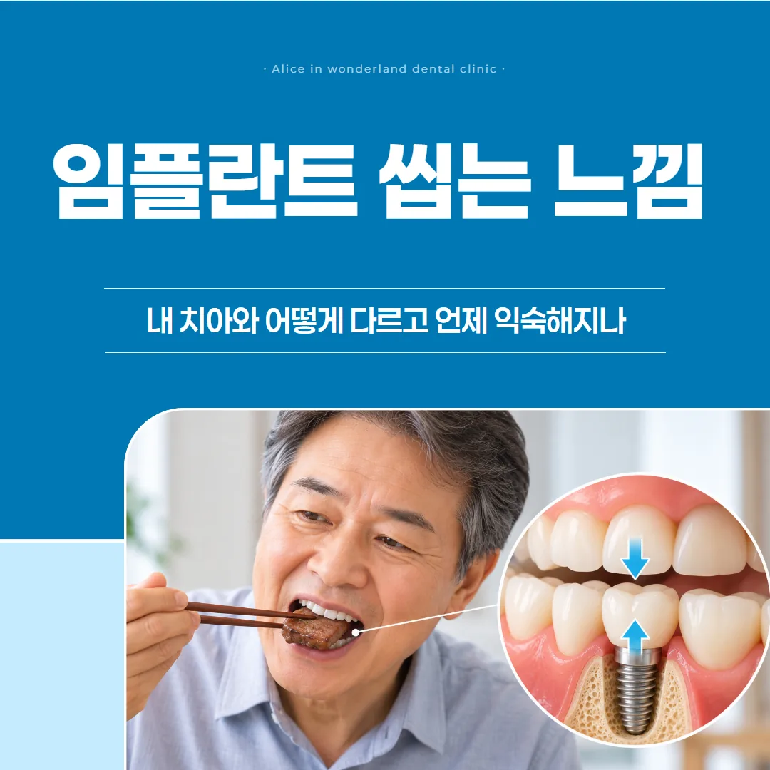 임플란트 씹는 느낌, 내 치아와 어떻게 다르고 언제 익숙해지나