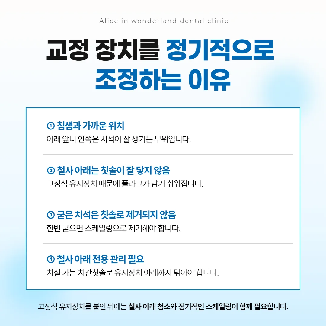 정해진 간격으로 장치를 조정하는 동안 치아가 조금씩 옮겨 가고 뼈가 함께 바뀌는 흐름 그림